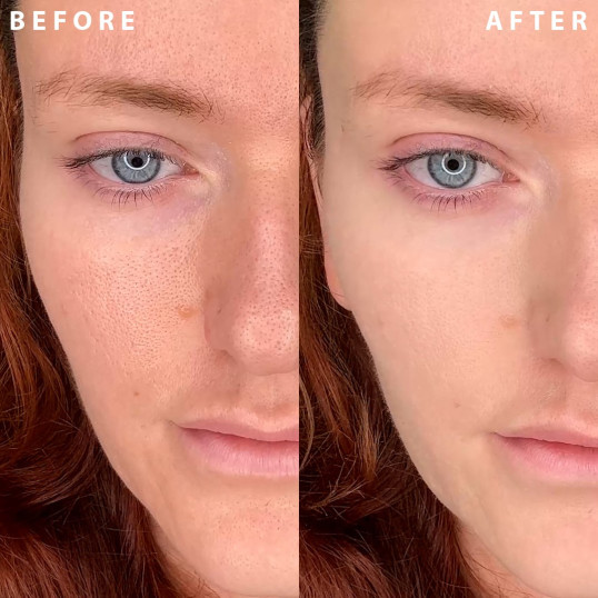 Power Camo Redness Defense